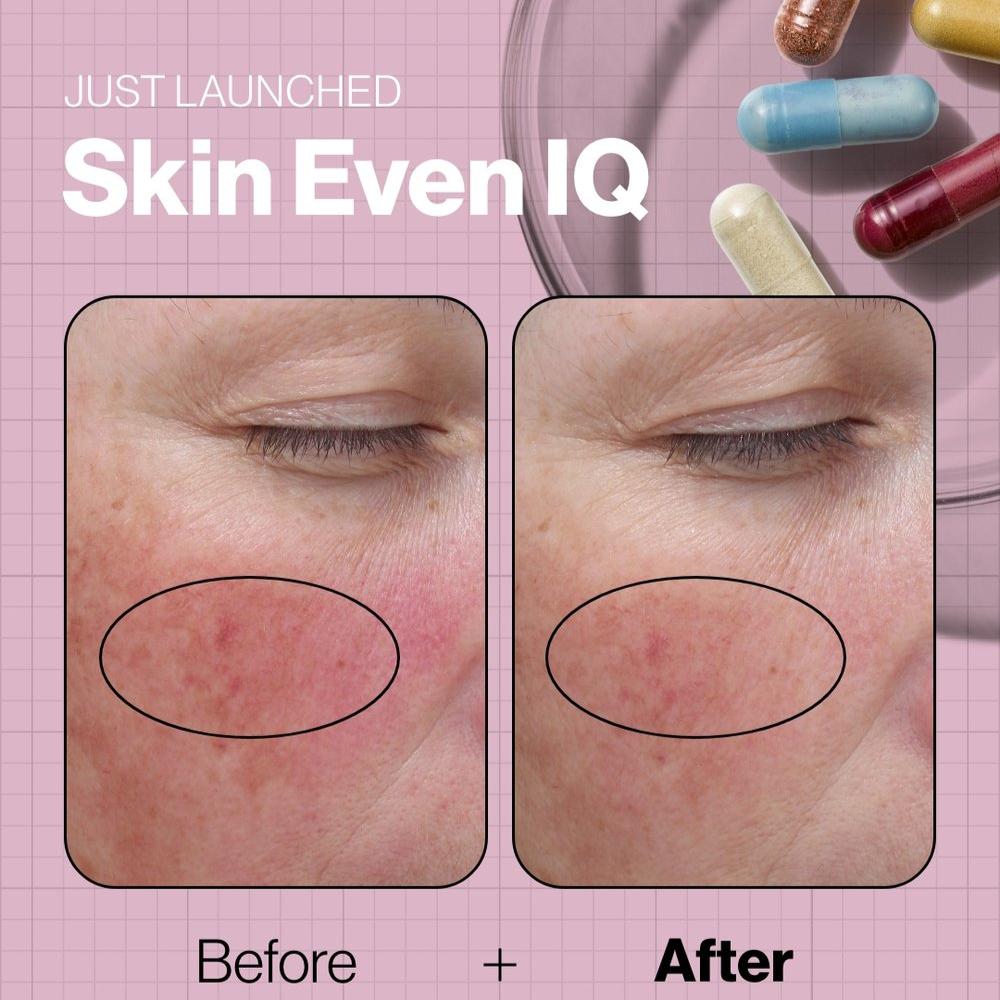 Skin Even IQ - The Kelly Clinic